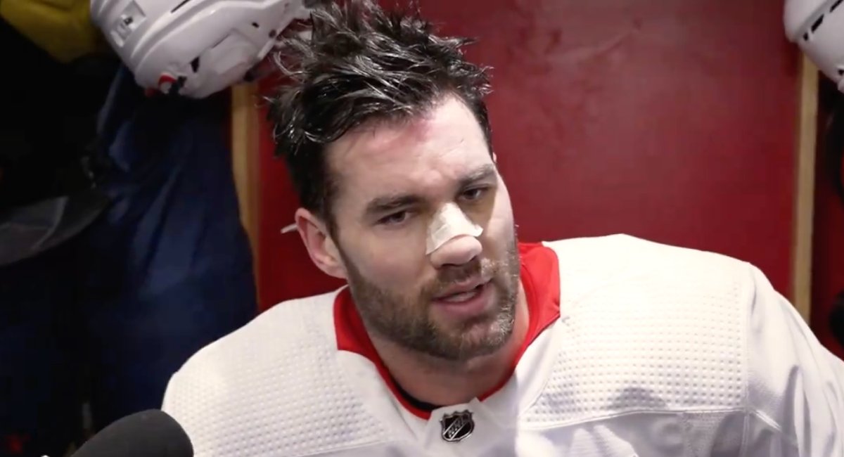 Tom Wilson optimistic about playing in next game despite painful recovery ‘You don’t